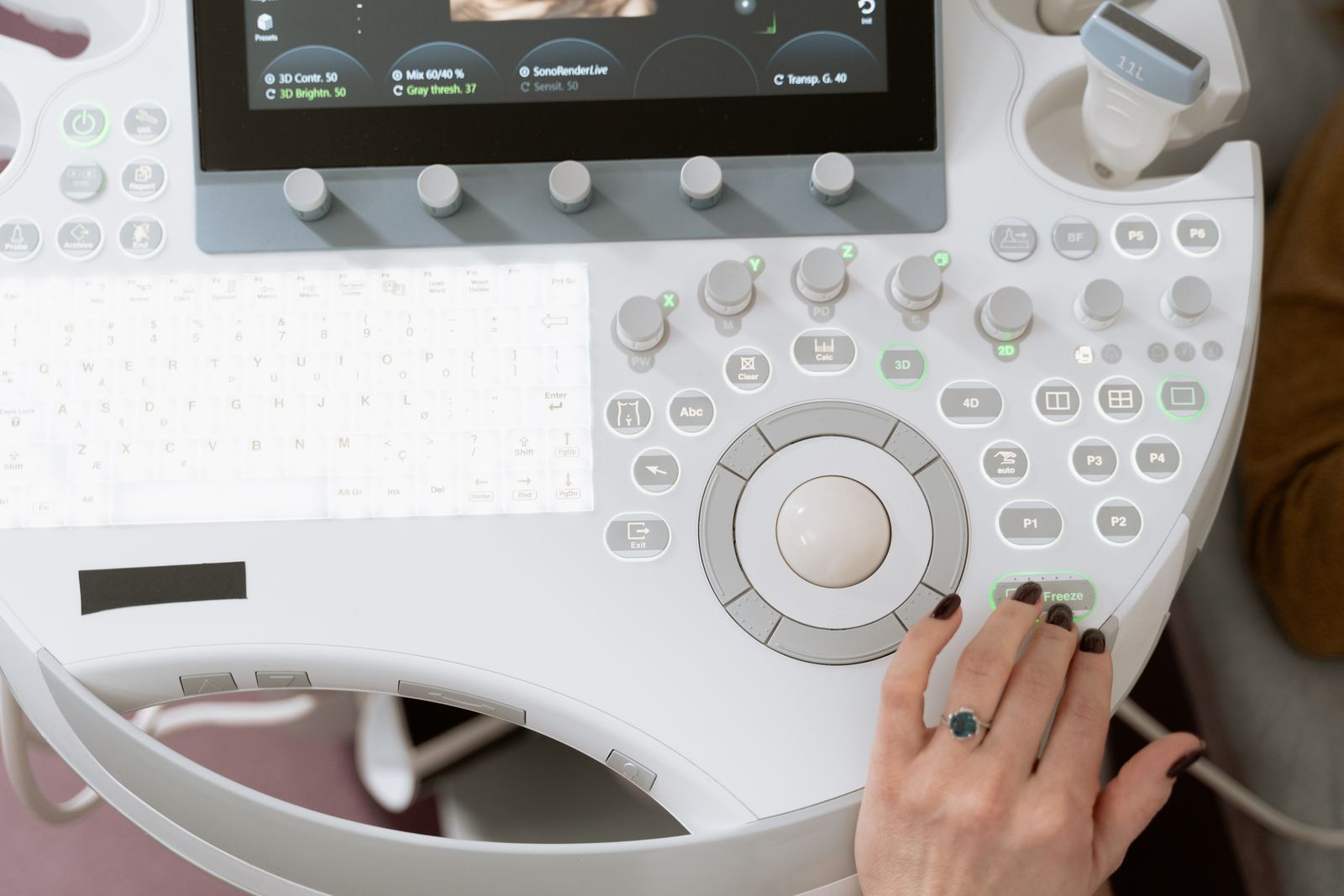 Infiltration sous guidage échographique